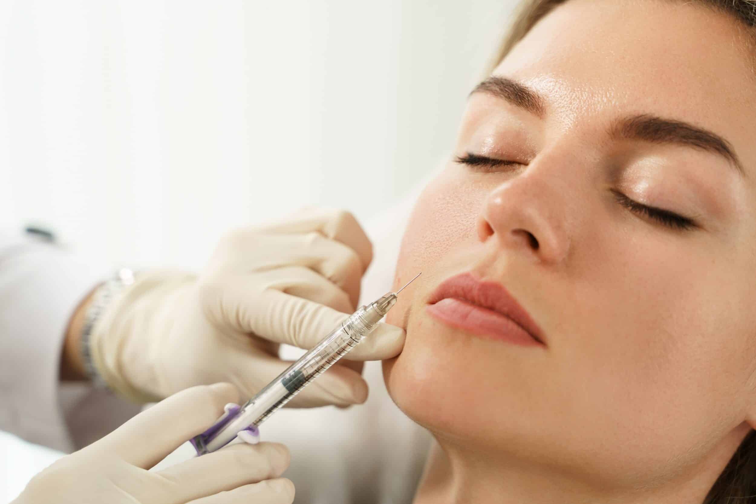 Juvederm injections in Scottsdale give woman a full, youthful face.
